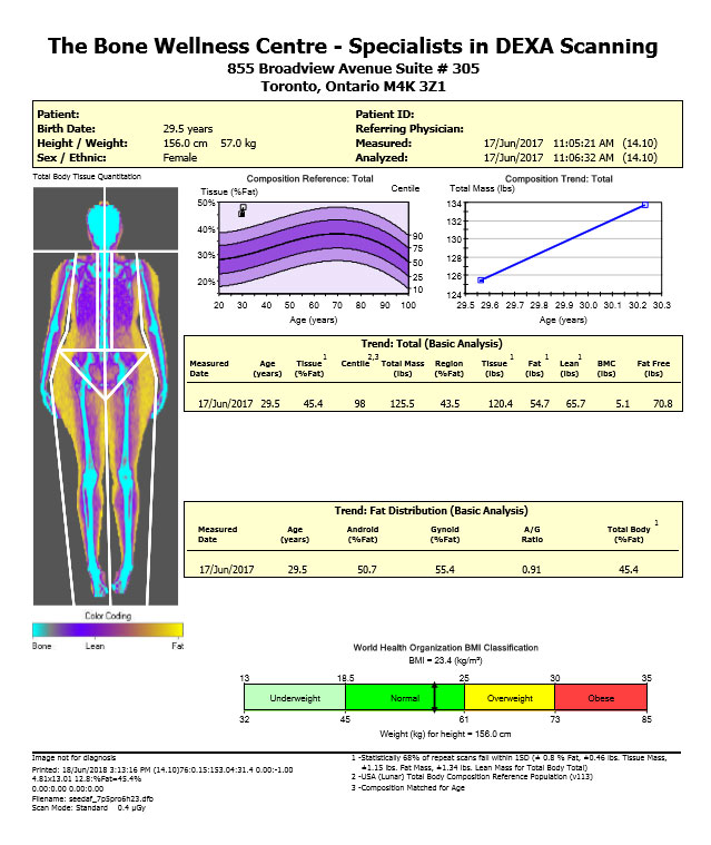 What A DEXA Scan Can Tell You About Your Longevity